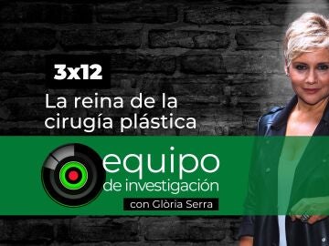 Equipo de investigaci&oacute;n 3x12: La reina de la cirug&iacute;a pl&aacute;stica 